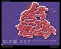E.coli electron micrograph, O157:H7